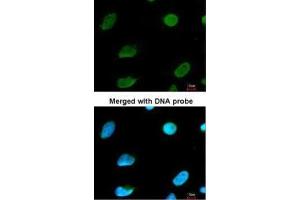 Immunofluorescence (IF) image for anti-Core-binding Factor, Runt Domain, alpha Subunit 2, Translocated To, 2 (CBFA2T2) (C-Term) antibody (ABIN2856638)