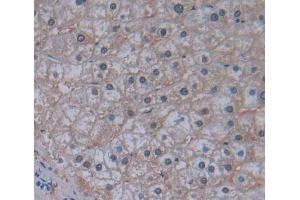 IHC-P analysis of liver tissue, with DAB staining. (MARS Antikörper  (AA 74-198))