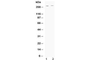 Western blot testing of human 1) HeLa and 2) A549 cell lysate with ABCC1 antibody at 0. (ABCC1 Antikörper  (AA 1493-1528))