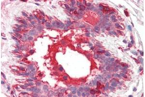 Human Breast (formalin-fixed, paraffin-embedded) stained with HGF antibody ABIN461958 at 10 ug/ml followed by biotinylated anti-mouse IgG secondary antibody ABIN481714, alkaline phosphatase-streptavidin and chromogen. (HGF Antikörper)