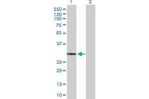 Western Blotting (WB) image for anti-Major Histocompatibility Complex, Class II, DQ alpha 1 (HLA-DQA1) (AA 1-255) antibody (ABIN516497)