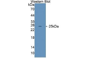 Detection of Recombinant LRP2, Human using Polyclonal Antibody to Low Density Lipoprotein Receptor Related Protein 2 (LRP2) (LRP2 Antikörper  (AA 4035-4184))