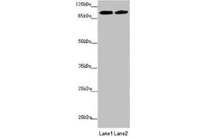 Western blot All lanes: PDE6A antibody at 3. (PDE6A Antikörper  (AA 656-860))