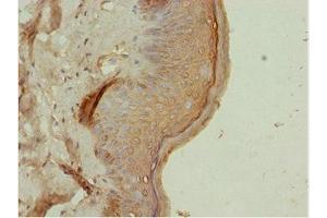 Immunohistochemistry of paraffin-embedded human skin tissue using ABIN7144821 at dilution of 1:100 (ATM Interactor Antikörper  (AA 160-360))