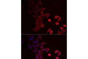 Immunofluorescence analysis of MCF7 cells using P2RX4 Polyclonal Antibody (P2RX4 Antikörper)
