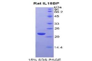 SDS-PAGE analysis of Rat IL18BP Protein. (IL18BP Protein)