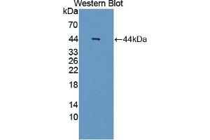 Detection of Recombinant AIM2, Human using Polyclonal Antibody to Absent In Melanoma 2 (AIM2) (AIM2 Antikörper  (AA 1-343))
