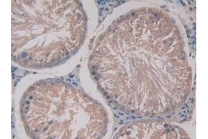 Used in DAB staining on fromalin fixed paraffin- embedded stomach tissue (GAS6 Antikörper  (AA 100-312))