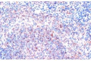 Immunohistochemistry of paraffin-embedded Mouse spleen using P90RSK Polyclonal Antibody at dilution of 1:100 (40x lens). (RPS6KA3 Antikörper)