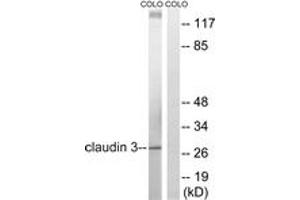 Western blot analysis of extracts from COLO205 cells, treated with EGF 200ng/ml 30', using Claudin 3 (Ab-219) Antibody. (Claudin 3 Antikörper  (AA 171-220))