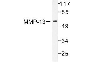 Image no. 1 for anti-Matrix Metallopeptidase 13 (Collagenase 3) (MMP13) antibody (ABIN265524)