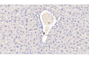 Detection of CRP in Mouse Liver Tissue using Polyclonal Antibody to C Reactive Protein (CRP) (CRP Antikörper  (AA 20-225))
