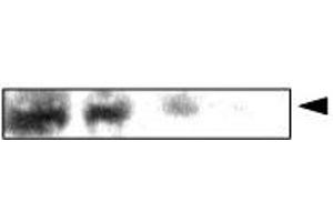 Western Blotting (WB) image for anti-Crystallin, alpha A (CRYAA) antibody (ABIN6245676) (CRYAA Antikörper)