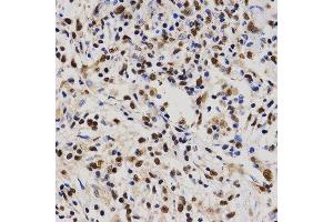 Immunohistochemistry (IHC) image for anti-Proline-, Glutamic Acid- and Leucine-Rich Protein 1 (PELP1) (AA 1021-1180) antibody (ABIN3023502) (PELP1 Antikörper  (AA 1021-1180))