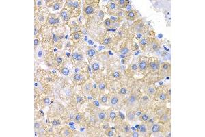 Immunohistochemistry (IHC) image for anti-V-Crk Sarcoma Virus CT10 Oncogene Homolog (Avian) (CRK) (AA 1-304) antibody (ABIN3015531) (Crk Antikörper  (AA 1-304))