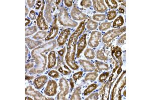 Immunohistochemistry (IHC) image for anti-Natriuretic Peptides B (NPPB) (AA 1-134) antibody (ABIN3023136)