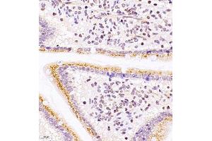 Immunohistochemistry of paraffin embedded mouse duodenum using ASBT (ABIN7075648) at dilution of 1:1500 (400x lens) (SLC10A2 Antikörper)