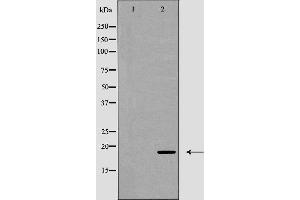Western blot analysis of CD3 ζ (Phospho-Tyr142) expression in Jurkat cell lysate . (CD247 Antikörper  (pTyr142))