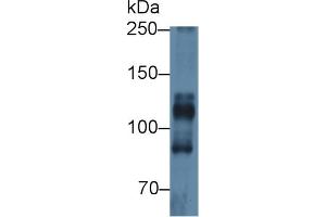 Detection of ATP1a1 in Mouse Heart lysate using Polyclonal Antibody to ATPase, Na+/K+ Transporting Alpha 1 Polypeptide (ATP1a1)