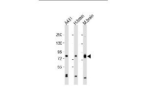 All lanes : Anti-PKC beta1/2 Antibody (Center) at 1:2000 dilution Lane 1: A431 whole cell lysate Lane 2: human brain lysate Lane 3: mouse brain lysate Lysates/proteins at 20 μg per lane. (PKC beta1/2 (AA 303-334) Antikörper)