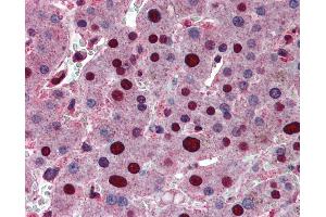 Immunohistochemistry (IHC) image for anti-Acidic (Leucine-Rich) Nuclear phosphoprotein 32 Family, Member A (ANP32A) (AA 1-250) antibody (ABIN790612)