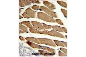 Formalin-fixed and paraffin-embedded human skeletal muscle reacted with ACTR2 Antibody (Center), which was peroxidase-conjugated to the secondary antibody, followed by DAB staining.