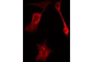 ABIN6277627 staining HeLa cells by IF/ICC.