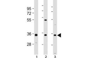 Western blot testing of 1) human 293T/17, 2) mouse brain and 3) human SH-SY5Y cell lysate with NAT8L antibody at 1:2000. (NAT8L Antikörper  (AA 59-93))
