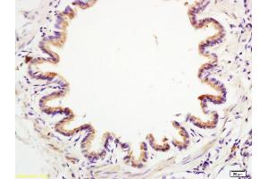 Formalin-fixed and paraffin embedded rat lung labeled with Anti-Anterior Gradient 2 Polyclonal Antibody, Unconjugated (ABIN710021) at 1:200 followed by conjugation to the secondary antibody and DAB staining. (AGR2 Antikörper  (AA 51-150))