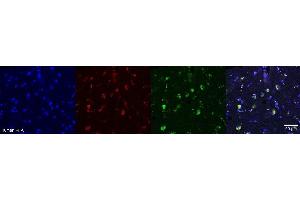 Immunohistochemistry (IHC) image for anti-Oligodendrocytic Myelin Paranodal and Inner Loop Protein (OPALIN) antibody (ABIN7456340) (OPALIN Antikörper)