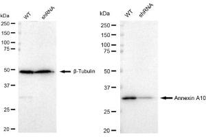 Western blotting analysis using Annexin A10 antibody (ABIN7797615).