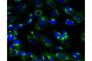 Immunofluorescent staining of SK-N-SH cells (right). (PRKAR2B Antikörper  (AA 1-418))