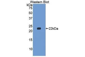 Western Blotting (WB) image for anti-Casein beta (CSN2) (AA 41-198) antibody (ABIN1867412) (CSN2 Antikörper  (AA 41-198))