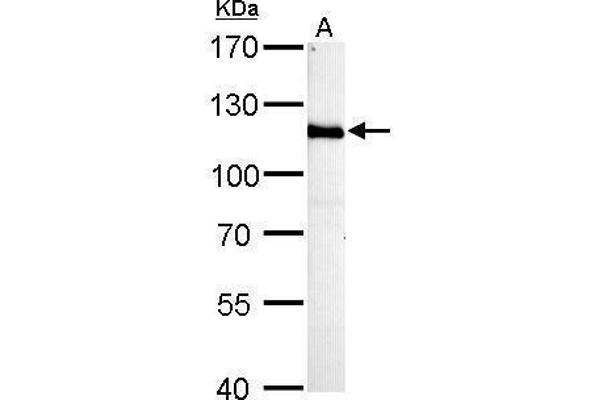 HGS Antikörper  (C-Term)