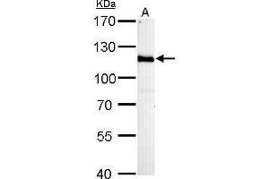 WB Image HGS antibody [C2C3], C-term detects HGS protein by Western blot analysis. (HGS Antikörper  (C-Term))