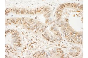 anti-Slingshot Homolog 3 (SSH3) (AA 609-659) antibody
