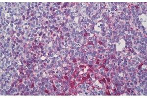 Anti-PDLIM1 antibody IHC staining of human tonsil. (PDLIM1 Antikörper  (AA 61-110))
