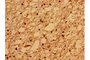 Immunohistochemistry of paraffin-embedded human brain tissue using ABIN7159092 at dilution of 1:100 (TMEM67 Antikörper  (AA 241-500))