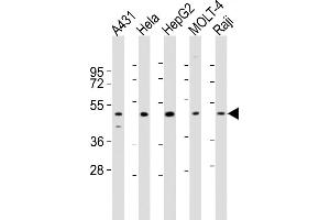 Western Blotting (WB) image for anti-Cytochrome P450, Family 24, Subfamily A, Polypeptide 1 (CYP24A1) (AA 34-64), (N-Term) antibody (ABIN6243389)