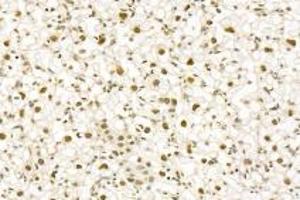 Immunohistochemistry (Paraffin-embedded Sections) (IHC (p)) image for anti-Pinin, Desmosome Associated Protein (PNN) antibody (ABIN7075083)