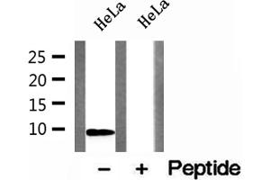 Western blot analysis of extracts of HeLa cells, using DSS1 antibody. (SHFM1 Antikörper)