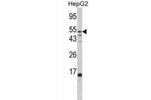 Western Blotting (WB) image for anti-Fucosidase, alpha-L- 1, Tissue (FUCA1) antibody (ABIN3002802) (FUCA1 Antikörper)