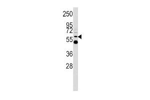 Western blot analysis of UDB17 antibody (Center) (ABIN390399 and ABIN2840791) in Y79 cell line lysates (35 μg/lane). (UGT2B17 Antikörper  (AA 119-147))