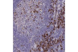 Immunohistochemical staining (Formalin-fixed paraffin-embedded sections) of human lymph node with SLAMF7 polyclonal antibody  shows strong cytoplasmic positivity in germinal center cells and non-germinal center cells. (SLAMF7 Antikörper  (AA 253-323))