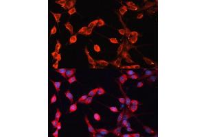 Immunofluorescence analysis of NIH-3T3 cells using  Polyclonal Antibody (ABIN6129875, ABIN6136541, ABIN6136542 and ABIN6224558) at dilution of 1:100 (40x lens). (ADAMTS13 Antikörper  (AA 1300-1400))
