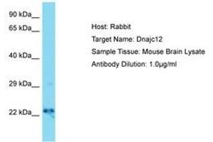 Image no. 1 for anti-DnaJ (Hsp40) Homolog, Subfamily C, Member 12 (DNAJC12) (AA 31-80) antibody (ABIN6750387) (DNAJC12 Antikörper  (AA 31-80))