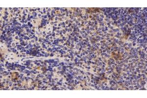Immunohistochemistry (IHC) image for anti-Adhesion Regulating Molecule 1 (Adrm1) (AA 2-407) antibody (ABIN7443221)