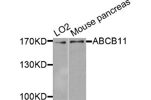 Western blot analysis of extracts of various cell lines, using ABCB11 antibody. (ABCB11 Antikörper)