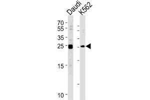 Western Blotting (WB) image for anti-MOB Kinase Activator 1B (MOB1B) antibody (ABIN3002948) (MOBKL1A Antikörper)