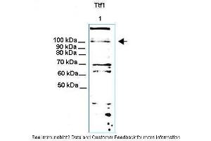 Lanes:  30ug NIH3T3 cell lysate Primary Antibody Dilution:  1:1000 Secondary Antibody:  Anti-rabbit HRP Secondary Antibody Dilution:  1: 5000 Gene Name:  Ttf1 Submitted by:  Thomas Moss (TTF1 Antikörper  (N-Term))